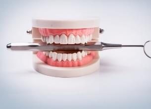 Root Canal Treatment